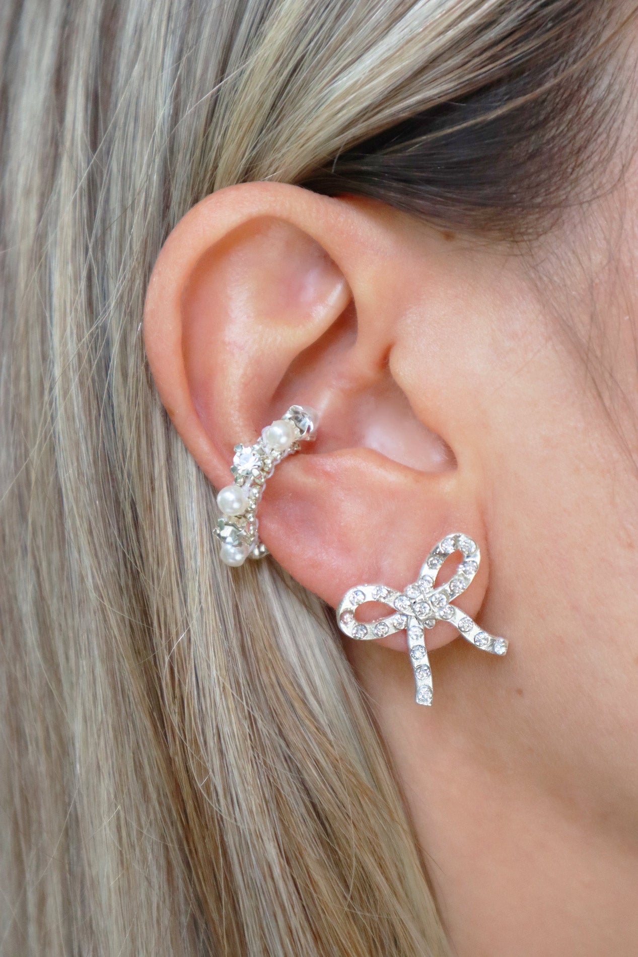 Aretes Radiant